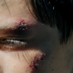 Nanda & Associate Lawyers Canada - Closeup of an injured face